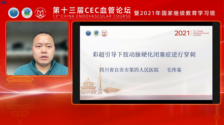 彩超引导下肢动脉硬化闭塞逆行穿刺-毛伟鉴