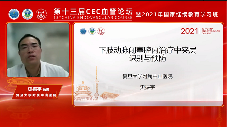 下肢动脉闭塞腔内治疗中夹层的识别与预防-史振宇