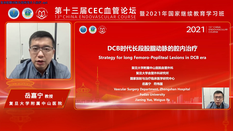 复杂股腘动脉长段病变介入治疗-岳嘉宁