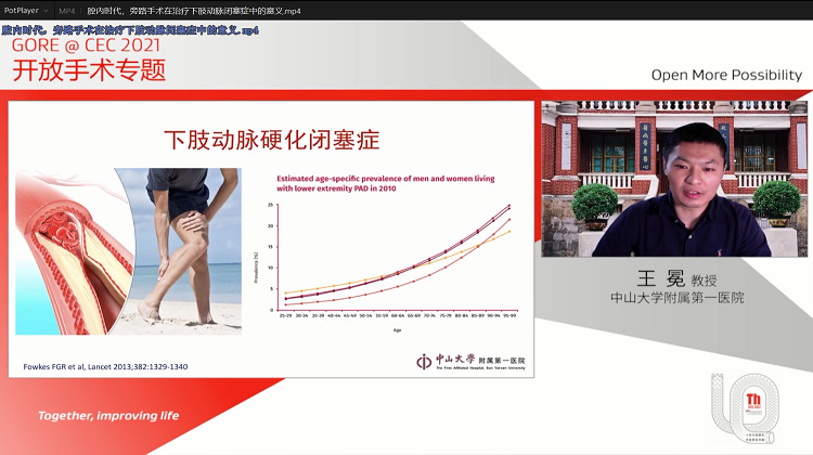 腔内时代，旁路手术在治疗下肢动脉闭塞症中的意义-王 冕