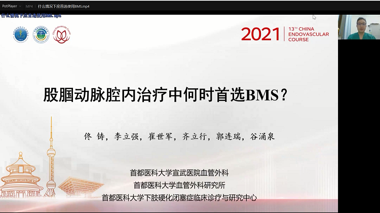 股腘动脉腔内治疗中何时首选BMS