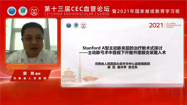 Stanford A型主动脉夹层的治疗新术式-梁凯