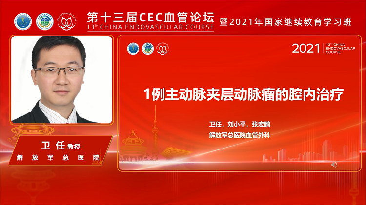 一例主动脉夹层动脉瘤的腔内治-卫任