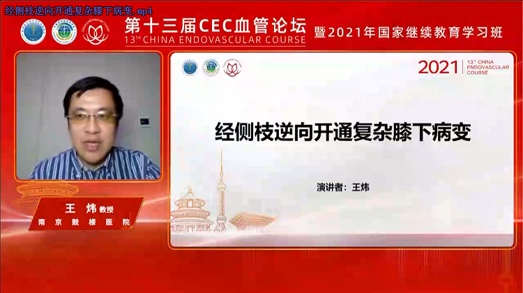 经侧枝逆向开通复杂膝下病变-王炜