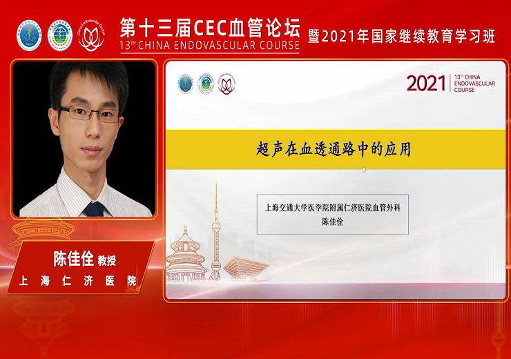 超声在透析通路中的应用-陈佳佺