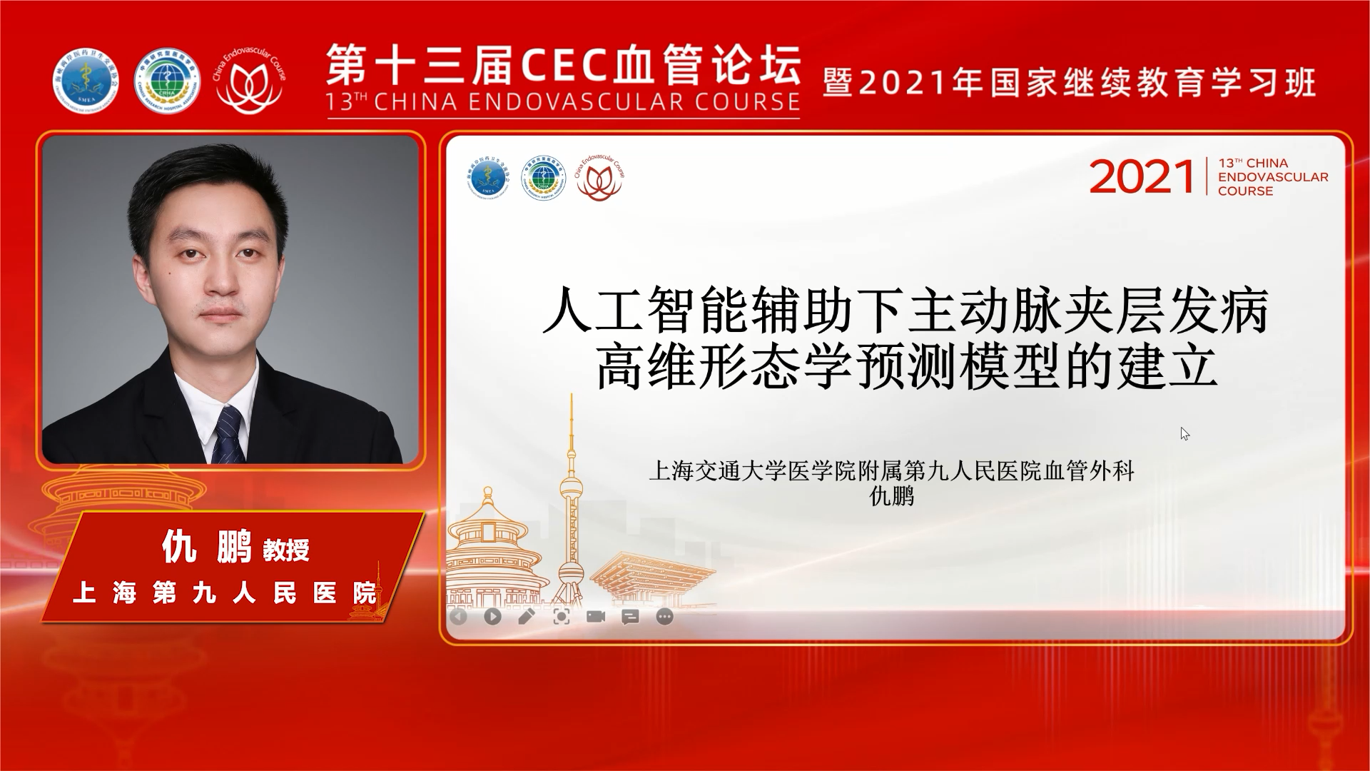 人工智能辅助下主动脉夹层发病高维形态学预测模型的建立-仇鹏