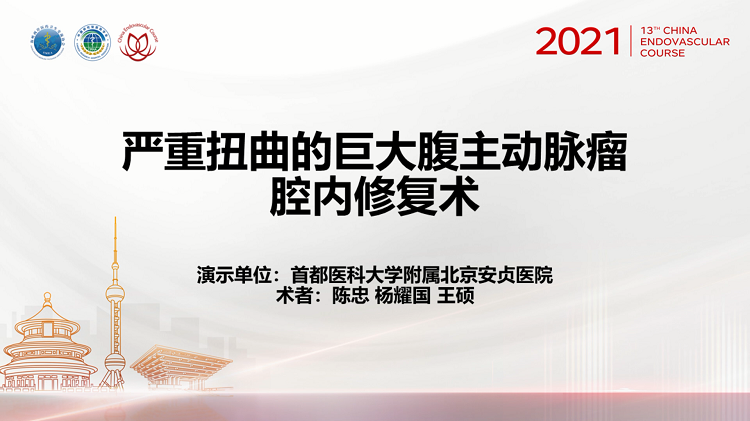 安贞医院&mdash;严重扭曲的巨大腹主动脉瘤腔内修复术-陈忠