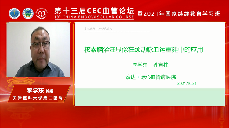 核素脑灌注显像在颈动脉运重建中的应用-李学东