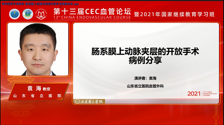 肠系膜上动脉夹层的开放手术病例分享-袁海