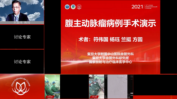 复旦中山&mdash;腹主动脉瘤病例手术演示