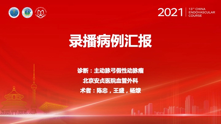 安贞医院&mdash;主动脉弓假性动脉瘤