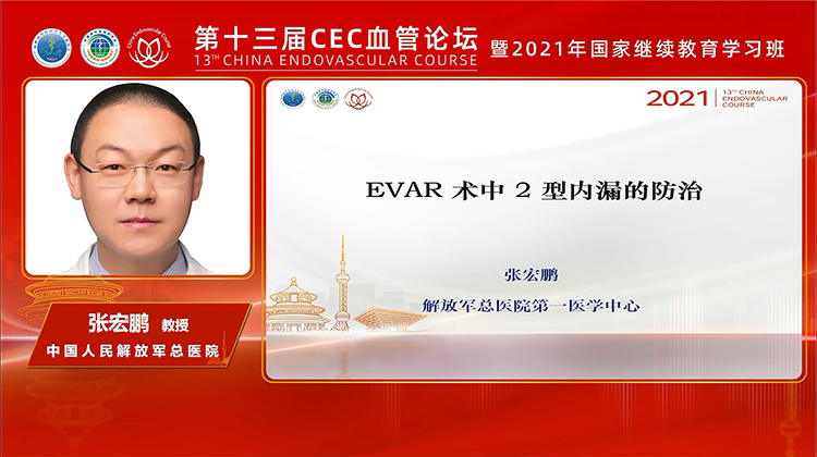 EVAR术中2型内漏的防治-张宏鹏