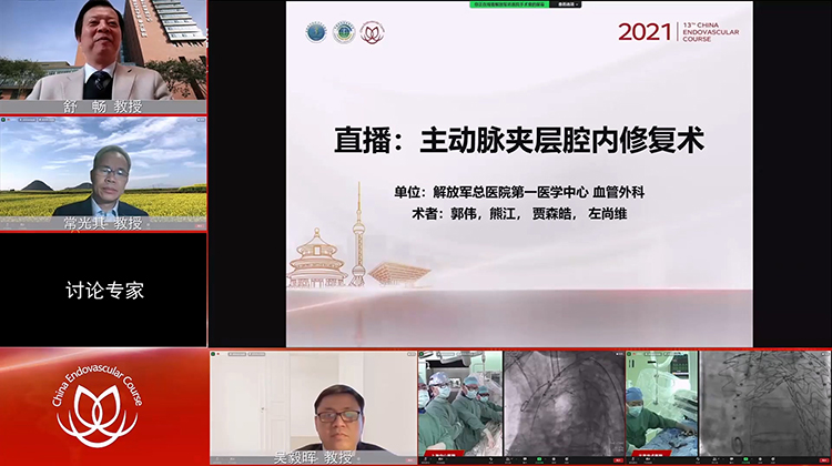 301医院&mdash;主动脉夹层腔内修复术