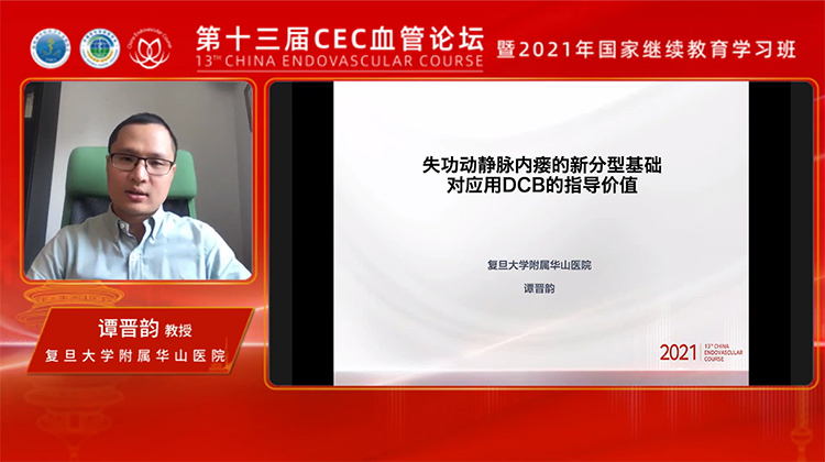 失功动静脉内瘘新分型基础对应用DCB的指导价值-谭晋韵