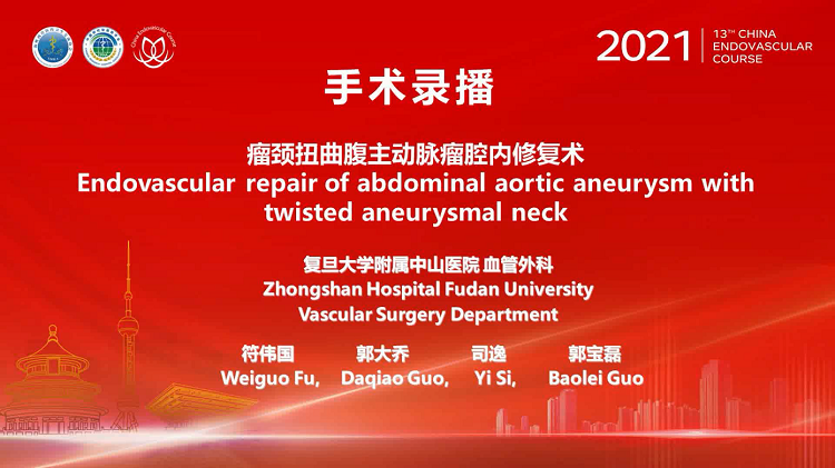 复旦中山&mdash;瘤颈扭曲腹主动脉瘤腔内修复术