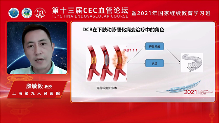 什么情况下可以首选使用DCB-殷敏毅