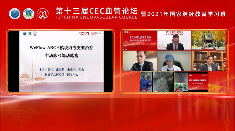 301医院&mdash;WeFlow-ARCH模块内嵌支架治疗主动脉弓部动脉瘤