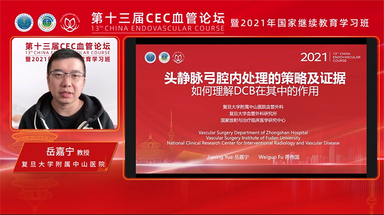 头静脉弓腔内处理的策略及证据&mdash;如何理解DCB在其中的作用