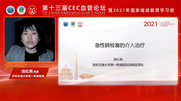 急性肺栓塞介入治疗和进展-田红燕