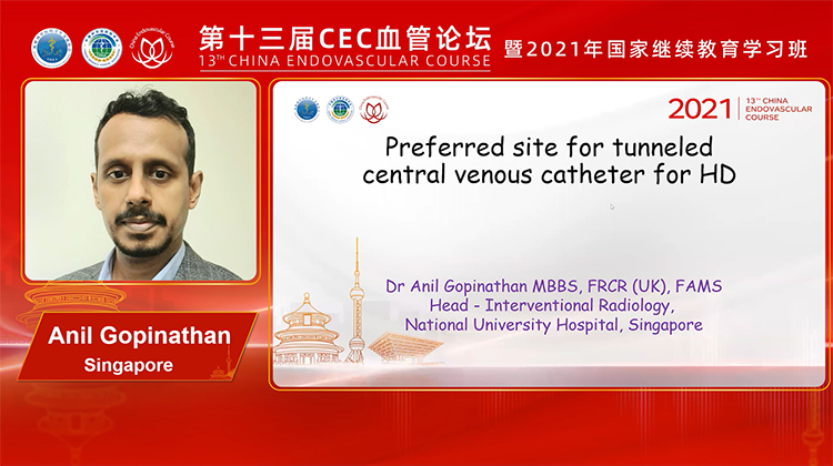 DASy@CEC-选择哪一侧植入透析导管？-Anil Gopinathan