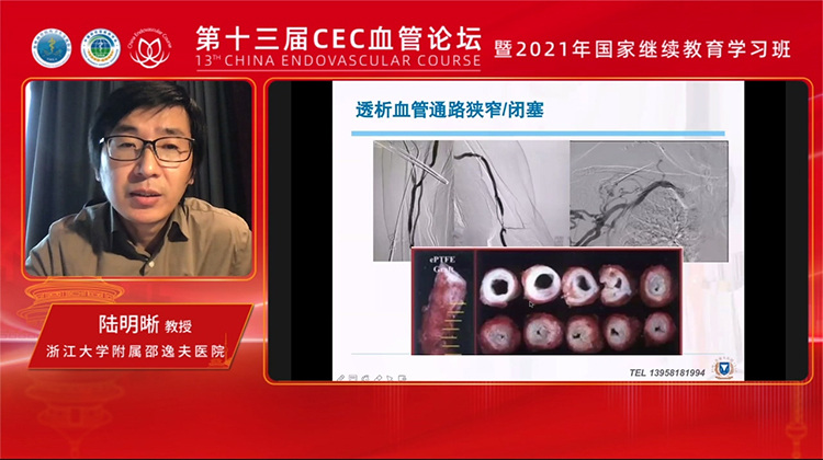 药涂，高压药涂，高压刻痕药涂的运用前景-陆明晰