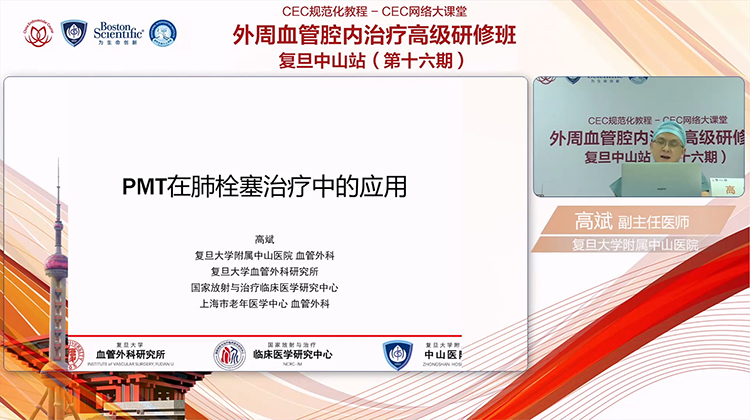 PMT在肺栓塞治疗的应用-高斌