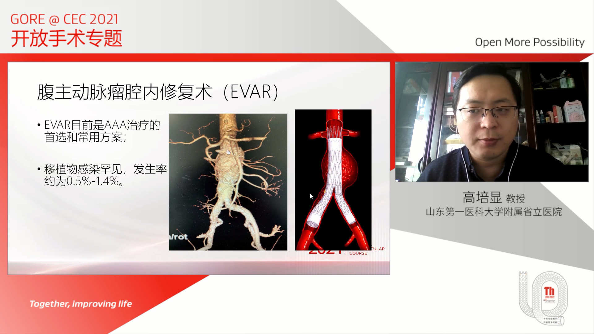 腹主动脉瘤腔内修复术后移植物感染的病因分析和治疗策略探讨-高培显