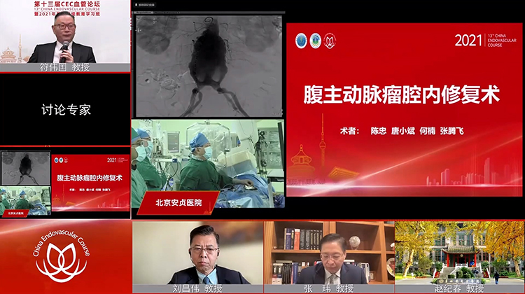 安贞医院&mdash;腹主动脉瘤腔内修复术