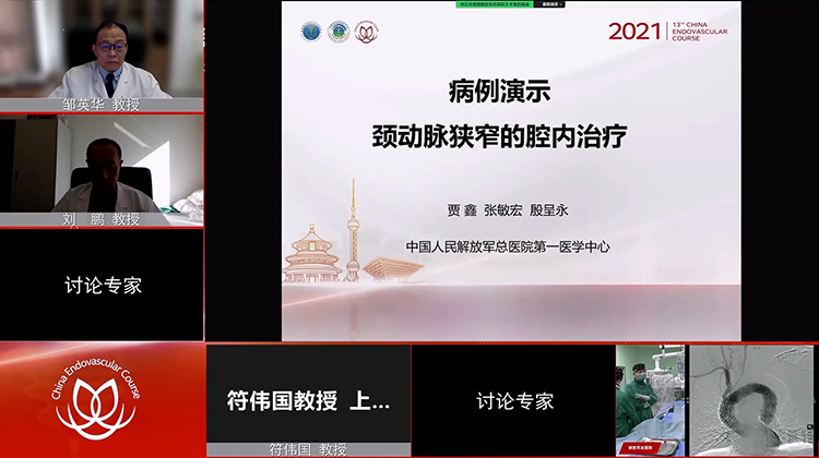 301医院&mdash;颈动脉狭窄的腔内治疗