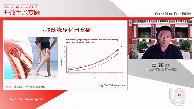 腔内时代，旁路手术在治疗下肢动脉闭塞症中的意义-王冕