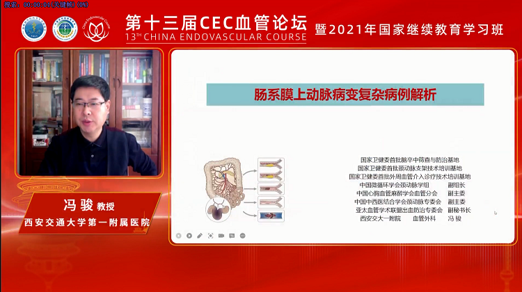 肠系膜上动脉病变复杂病例解析-冯骏