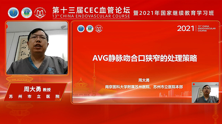 AVG静脉吻合口狭窄的处理策略-周大勇