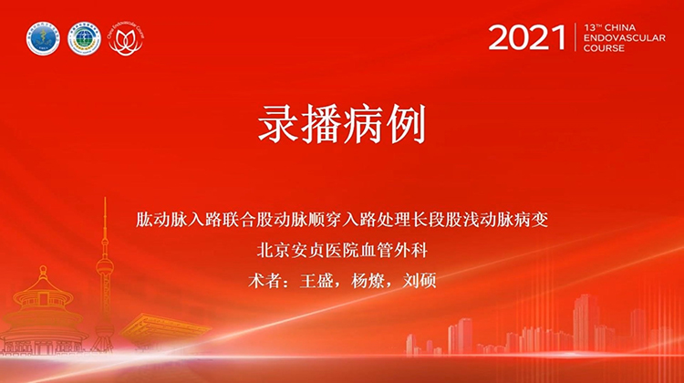 安贞医院&mdash;肱动脉入路联合股动脉顺穿入路处理长段股浅动脉病变
