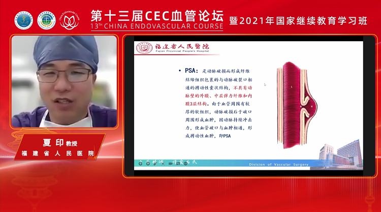 Proglide 血管缝合器在假性动脉瘤中的应用-夏印