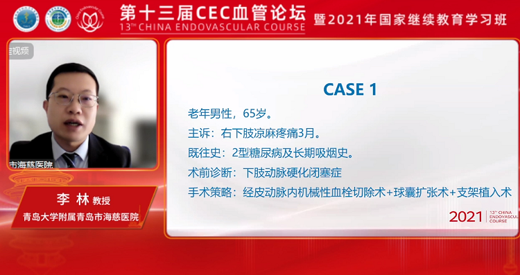 Fusmart&reg;：点亮可调弯时代：三管齐下，调弯+支撑+栓塞-李林