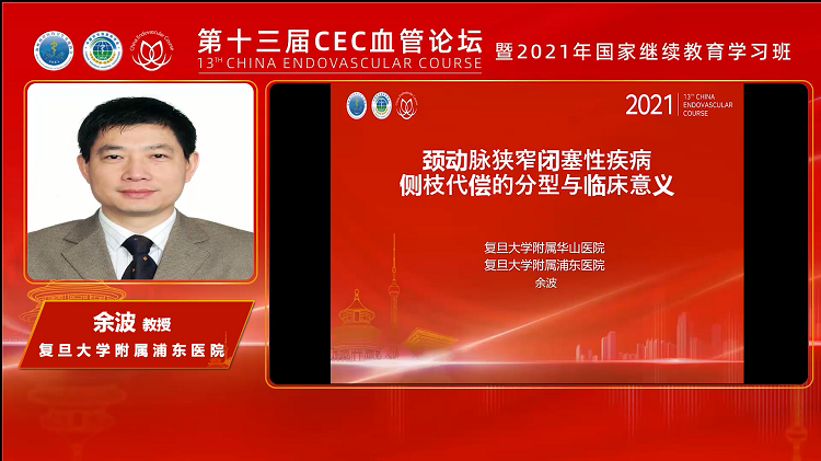 颈动脉狭窄闭塞性疾病侧枝代偿的分型与临床意义-余波