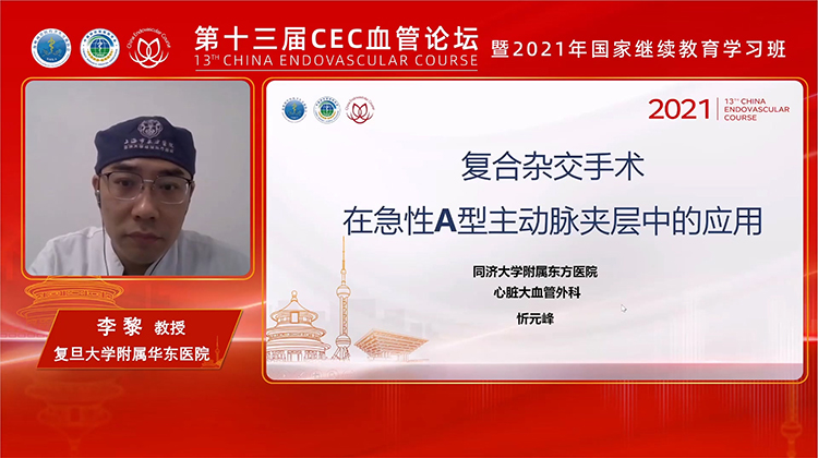 复合杂交手术在急性A型主动脉夹层中的应用-李黎