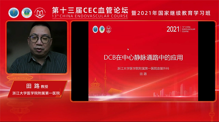 中心静脉DCB的应用经验-田路