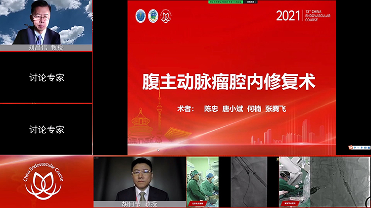 安贞医院&mdash;腹主动脉瘤腔内修复术