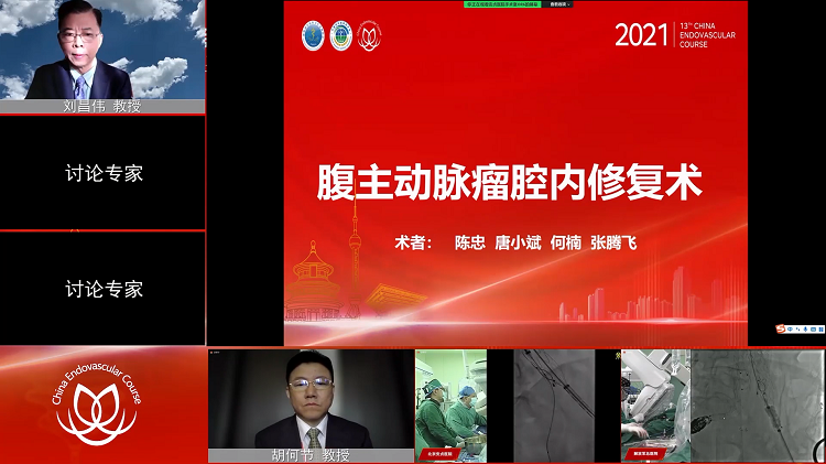 安贞医院&mdash;&mdash;腹主动脉瘤腔内修复术-陈忠