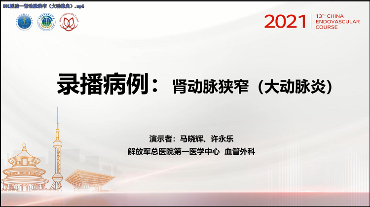 301医院&mdash;肾动脉狭窄（大动脉炎）