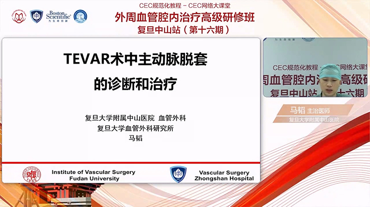 TEVAR术中主动脉脱套的诊断和治疗-马韬