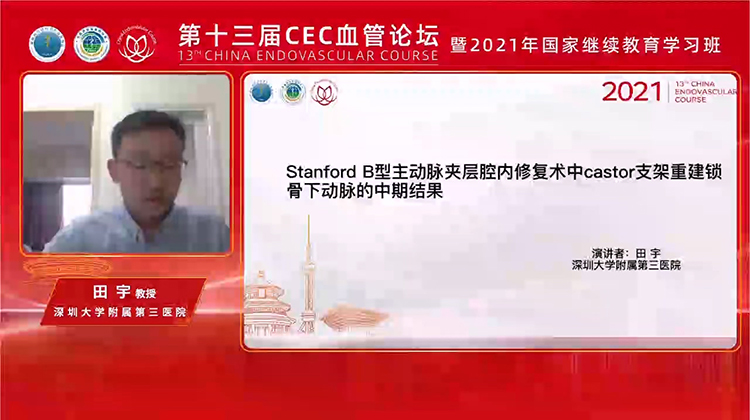 Stanford B型主动脉夹层腔内修复术中Castor 支架重建锁骨下动脉的中期结果-田宇