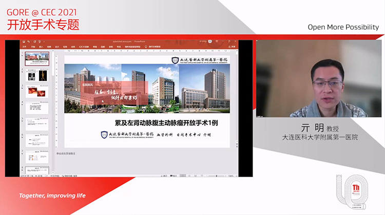 腹主动脉瘤开放手术修复一例-亓明