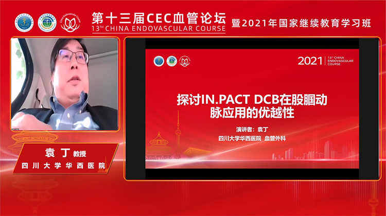 探讨IN.PACT DCB在股腘动脉应用的优越性-袁丁