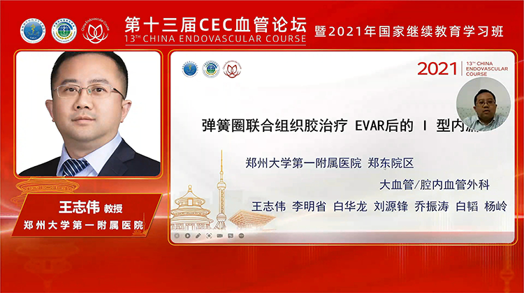 &ldquo;弹簧圈+组织胶&rdquo;治疗EVAR术后I型内漏-王志伟