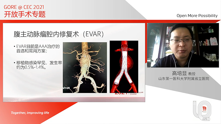 腹主动脉瘤腔内修复术后移植物感染的病因分析和治疗策略探讨-高培显