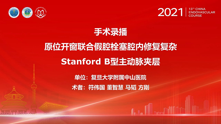 复旦中山&mdash;原位开窗联合假腔栓塞腔内修复复杂Stanford B 型主动脉夹层