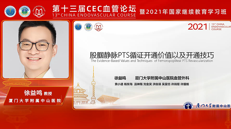 股腘静脉PTS循证开通价值以及开通技巧-徐益鸣