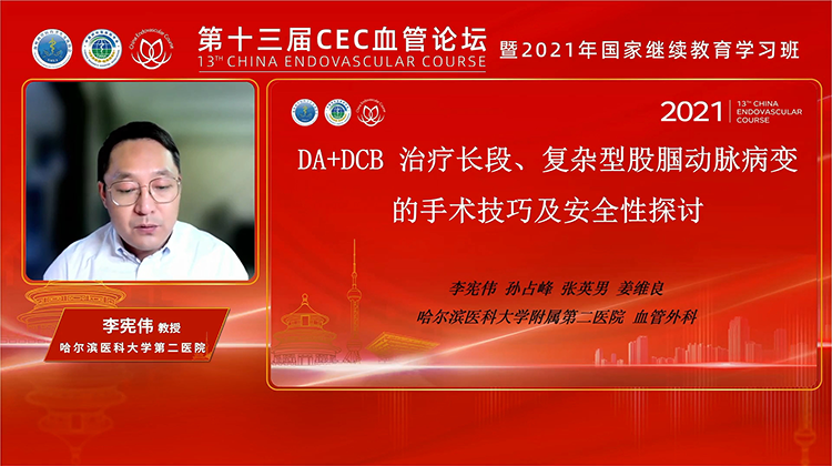 DA+DCB治疗长段、复杂型股腘动脉病变的手术技巧及安全性探讨-李宪伟